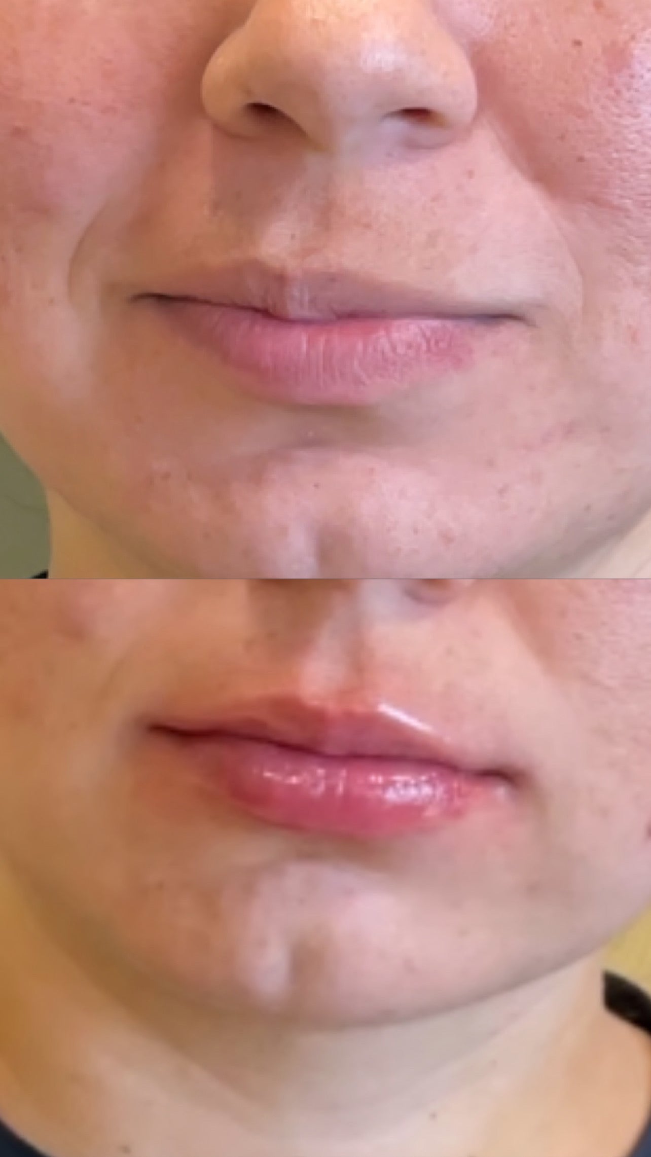 Pout Potion Lip Plumper